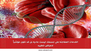 الكدمات المفاجئة على جسمك ليست عادية بل قد تكون مؤشراً لأمراض خطيرة